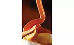 Caramel syrups can be used to enhance pouring throughout the sauce shelflife