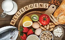 Letter Blocks Spell Out Allergens Placed Above Major Food Allergens