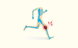 Graphic of Running Skeleton with Inflammation in Knee Joint