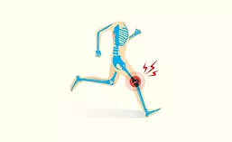 Graphic of Running Skeleton with Inflammation in Knee Joint
