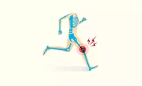 Graphic of Running Skeleton with Inflammation in Knee Joint